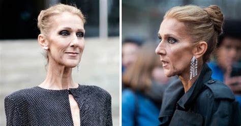 Celine Dion’s Shocking Weight Loss In Photos.